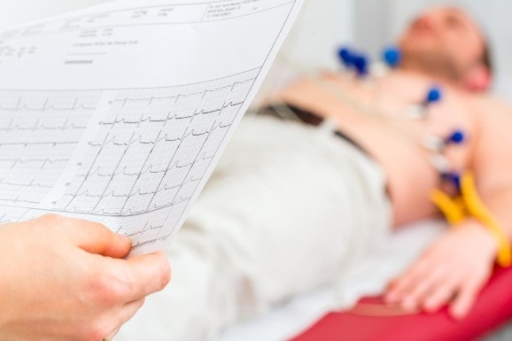 enfermedades cardiovasculares enfermedades cardiovasculares